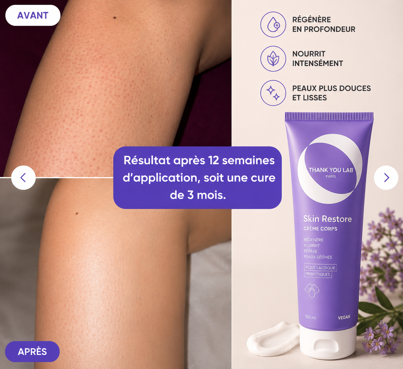 Skin Restore - Crème Kératose Pilaire Acide Lactique 10% - 150 ml