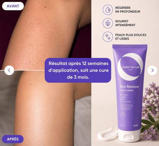 Skin Restore - Crème Kératose Pilaire Acide Lactique 10% - 150 ml