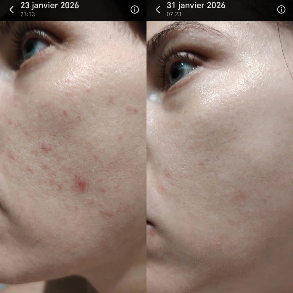 HÉVOÉ crème de nuit peeling éclat 40ml soin anti-âge peau lumineuse