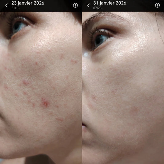 HÉVOÉ – Crème de Nuit Peeling Éclat – 40 ml