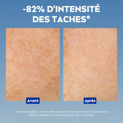 Nivea – Sérum Luminous 630 Anti-Taches (30 ml)